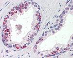 Annexin A1 Antibody in Immunohistochemistry (Paraffin) (IHC (P))