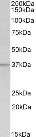 Annexin A1 Antibody in Western Blot (WB)