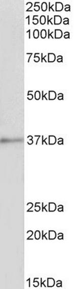 Annexin A1 Antibody in Western Blot (WB)