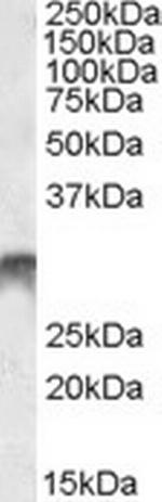 DLX5 Antibody in Western Blot (WB)