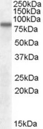 LIMP2 Antibody in Western Blot (WB)