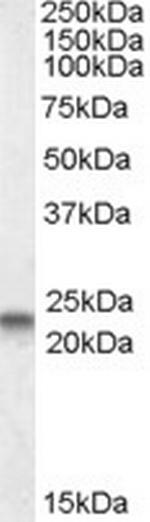 Caveolin 3 Antibody in Western Blot (WB)