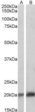 Caveolin 3 Antibody in Western Blot (WB)