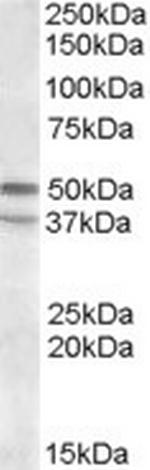 HTR7 Antibody in Western Blot (WB)