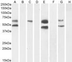CaMKII alpha Antibody in Western Blot (WB)