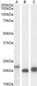 IL-18 Antibody in Western Blot (WB)