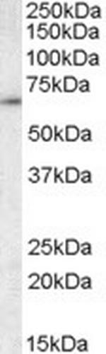 TCP-1 gamma Antibody in Western Blot (WB)