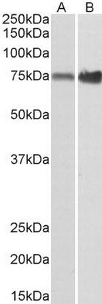 XPNPEP1 Antibody in Western Blot (WB)