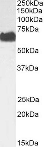 STK39 Antibody in Western Blot (WB)