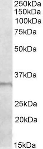 E2F6 Antibody in Western Blot (WB)