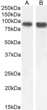 SATB1 Antibody in Western Blot (WB)