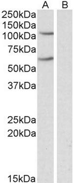 IREB2 Antibody in Western Blot (WB)