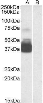 P2X7 Antibody in Western Blot (WB)