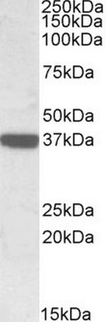 Calponin 3 Antibody in Western Blot (WB)