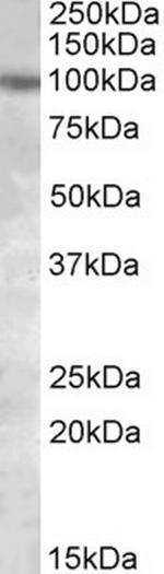 PKD2 Antibody in Western Blot (WB)