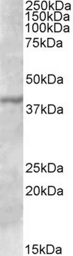 TFB1M Antibody in Western Blot (WB)