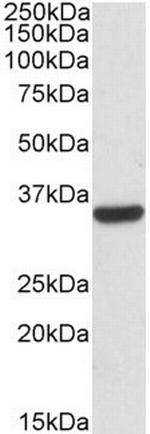 Calponin 2 Antibody in Western Blot (WB)