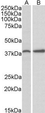 PRKCDBP Antibody in Western Blot (WB)