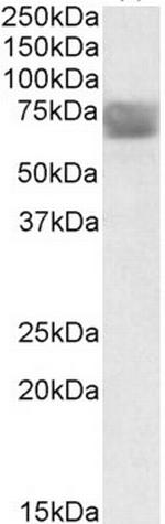 CLN2 Antibody in Western Blot (WB)