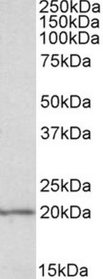 eIF5A Antibody in Western Blot (WB)