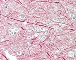 NEFM Antibody in Immunohistochemistry (Paraffin) (IHC (P))