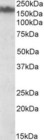 NEFM Antibody in Western Blot (WB)