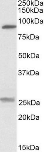 SLC4A11 Antibody in Western Blot (WB)