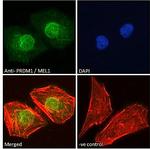 Blimp-1 Antibody in Immunocytochemistry (ICC/IF)