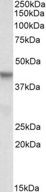 PINX1 Antibody in Western Blot (WB)