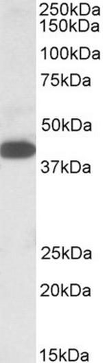 A4GNT Antibody in Western Blot (WB)