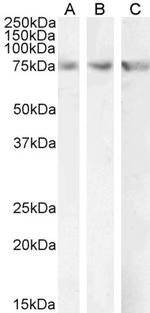 CPT2 Antibody in Western Blot (WB)