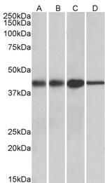 ACAT1 Antibody in Western Blot (WB)