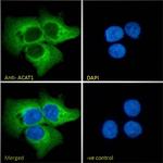 ACAT1 Antibody in Immunocytochemistry (ICC/IF)