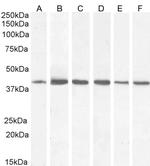 ACAT1 Antibody in Western Blot (WB)