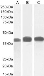 ACAT1 Antibody in Western Blot (WB)