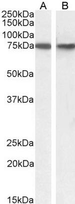 SNX1 Antibody in Western Blot (WB)