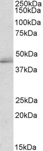 TIA1/TIAL1 Antibody in Western Blot (WB)