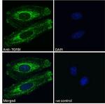 TGFBI Antibody in Immunocytochemistry (ICC/IF)