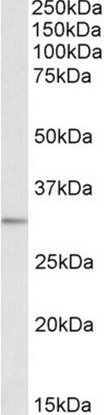 MAPRE3 Antibody in Western Blot (WB)