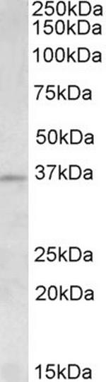 Aurora C Antibody in Western Blot (WB)