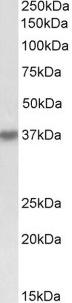 HSH2D Antibody in Western Blot (WB)