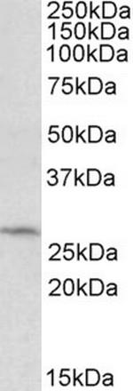 DCUN1D1 Antibody in Western Blot (WB)