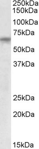 TTC8 Antibody in Western Blot (WB)