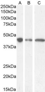 GNAS Antibody in Western Blot (WB)