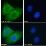 PLA2G4A Antibody in Immunocytochemistry (ICC/IF)