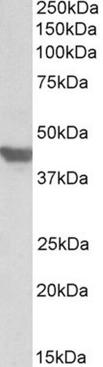 GLUT4 Antibody in Western Blot (WB)