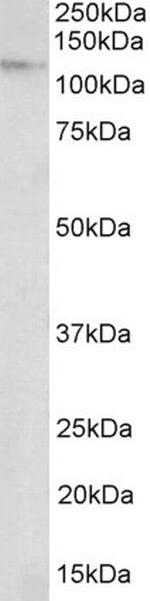 NUP107 Antibody in Western Blot (WB)