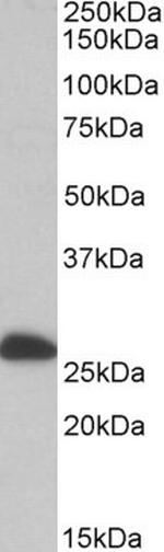 ETFB Antibody in Western Blot (WB)