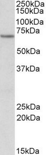 ETFDH Antibody in Western Blot (WB)