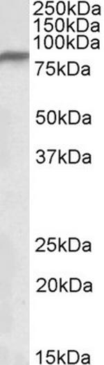 NDUFS1 Antibody in Western Blot (WB)